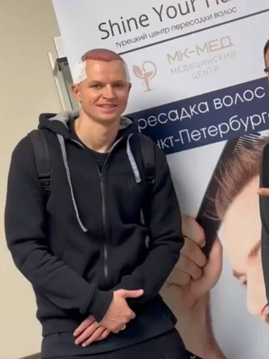    Дмитрий Тарасов делает пересадку волос Фото: Инстаграм (запрещен в РФ)