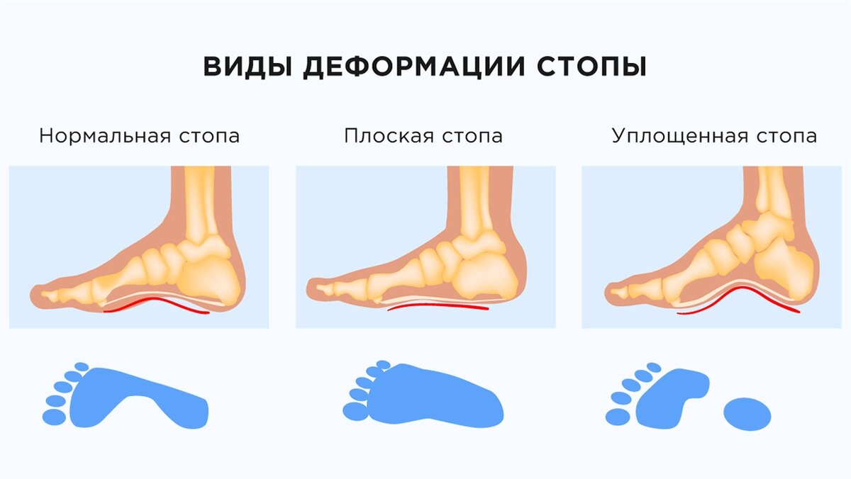 Стопа фундамент организма человека