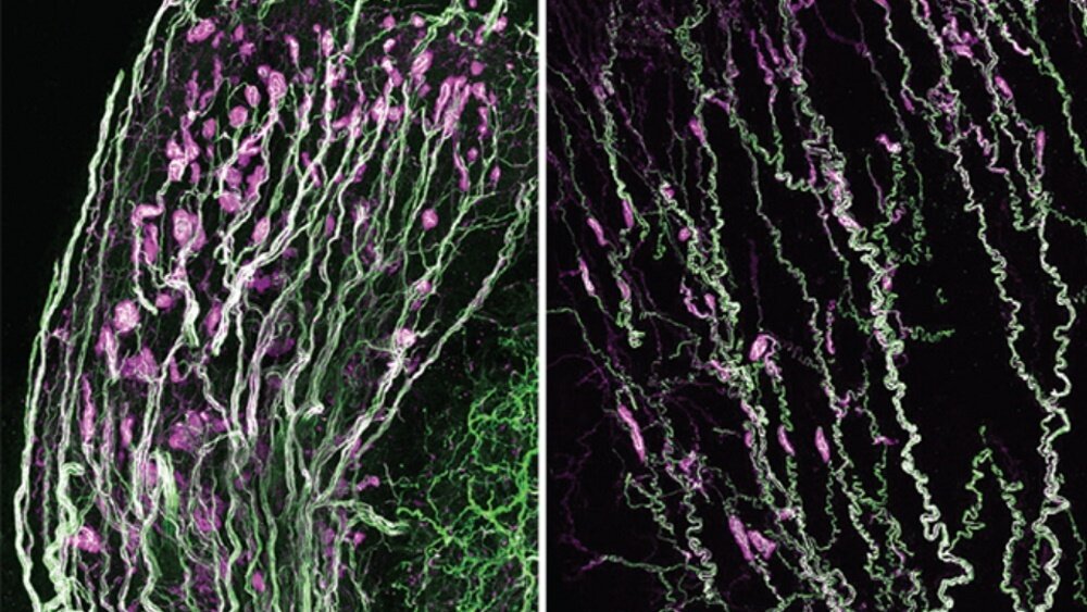    Фото: Qi et al., bioRxiv, 2023, Окрашенные тельца Краузе