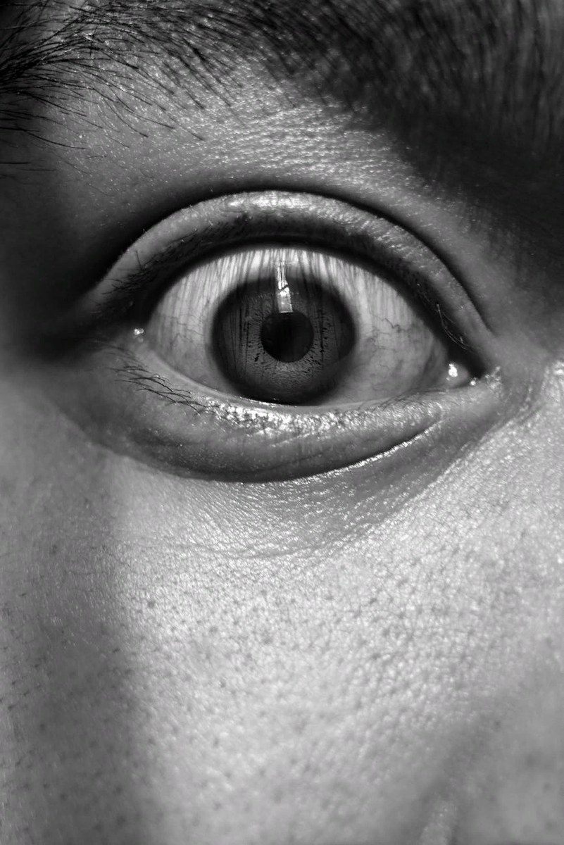 Многие думают, что их поры расширены. На самом деле они просто есть. Как и у всех.