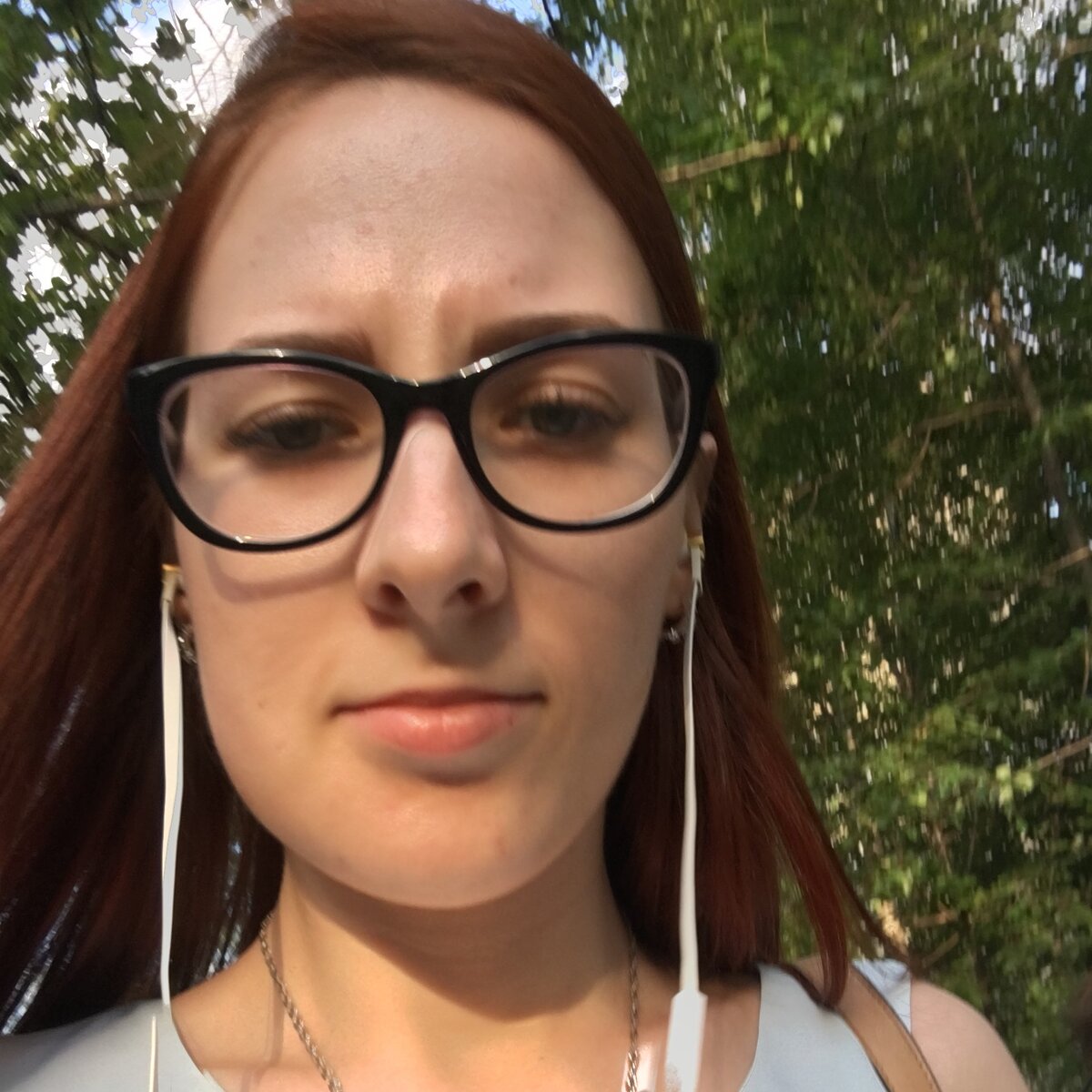 Тут мне удалили зуб мудрости. Отёк — доказательство :)