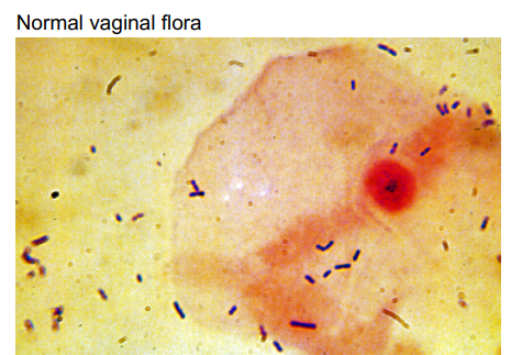 Дратути. Вас приветствует нормальная микроскопия: эпителиальная клеточка и лактобактерии (рис из Uptodate) 