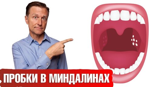 Как распознать ангину?