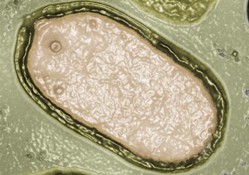 Пандоравирус в микроскопе