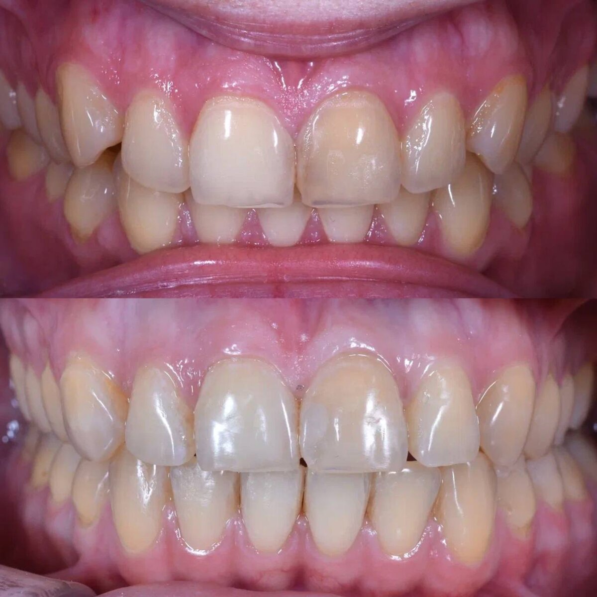 Результат лечения