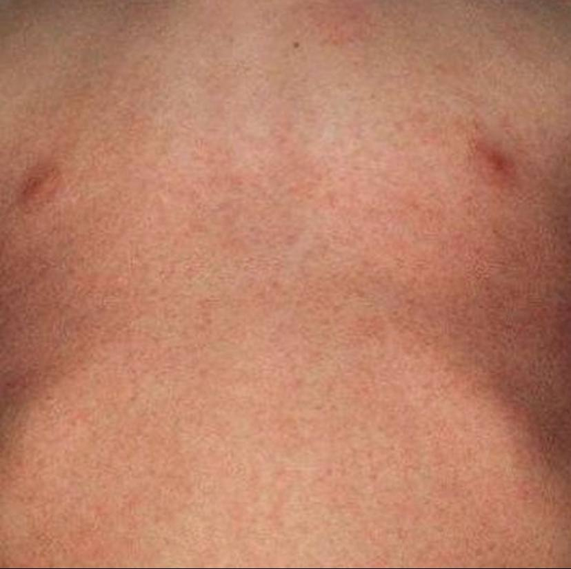 Источник medscape.com