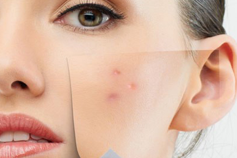 Фотография взята из источника elmaelma.com