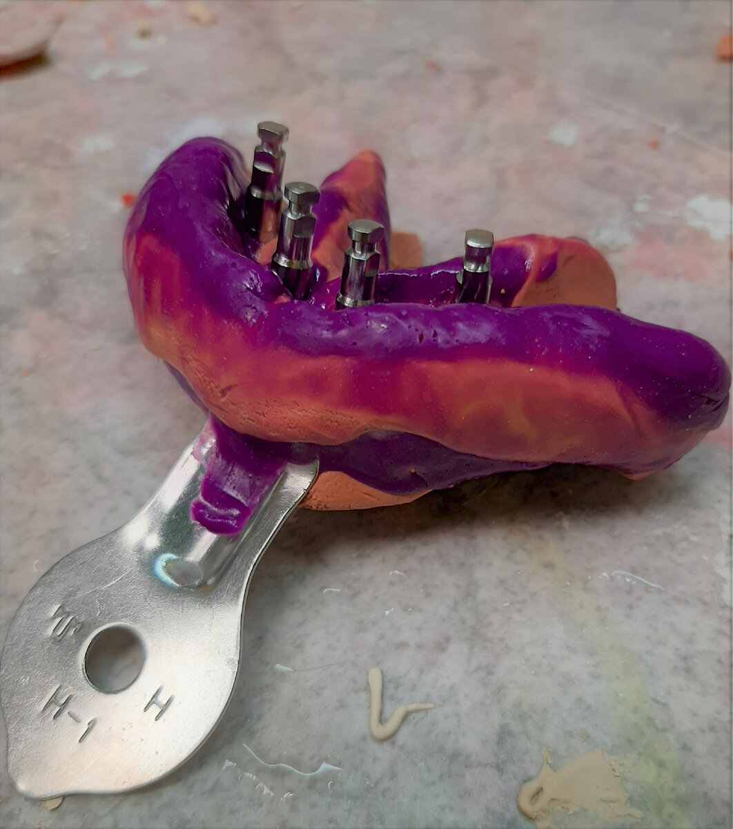 Это  свежий слепок моей нижней челюсти