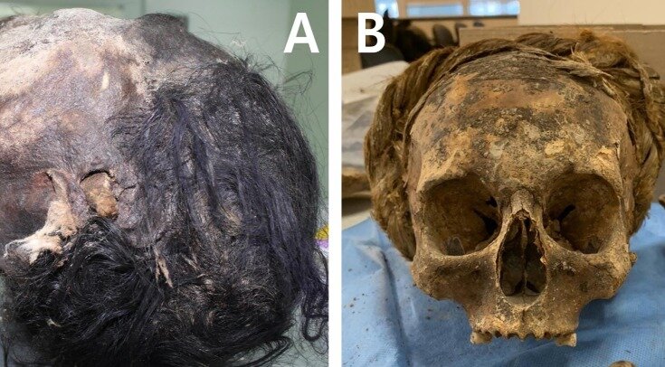     А – череп корейской мумии, B – череп русского поселенца из Сибири Jieun Kim et al. / Journal of Archaeological Science: Reports, 2022