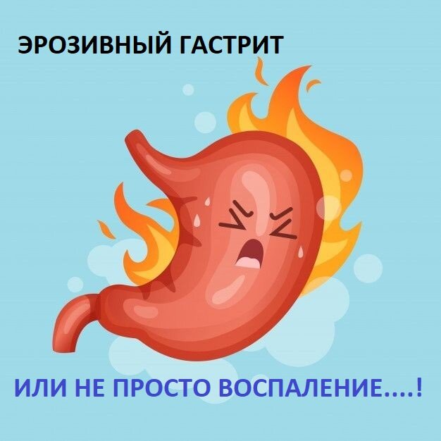 Эрозивный гастрит, или не просто воспаление...! | Доктор Силантьева | Дзен