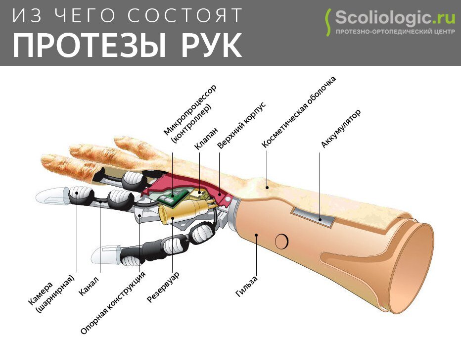 Как работают протезы. Строение бионического протеза руки. Схема бионического протеза руки. Протез кисти i-Limb Ultra. Из чего состоит бионический протез руки.