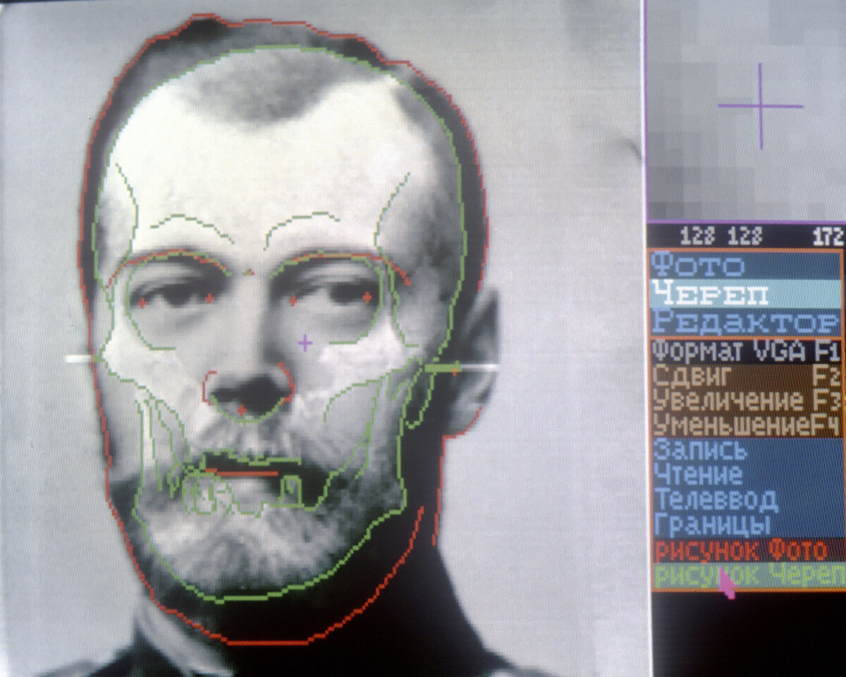 Исследование черепа царя Николая II методом фотографического наложения после обнаружения костей, найденных в 1991 году.