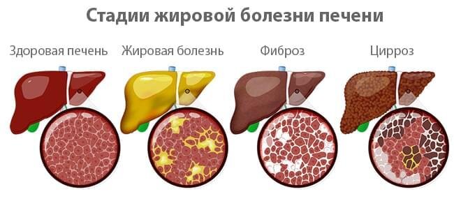 Как реагирует печень на снижение массы тела?