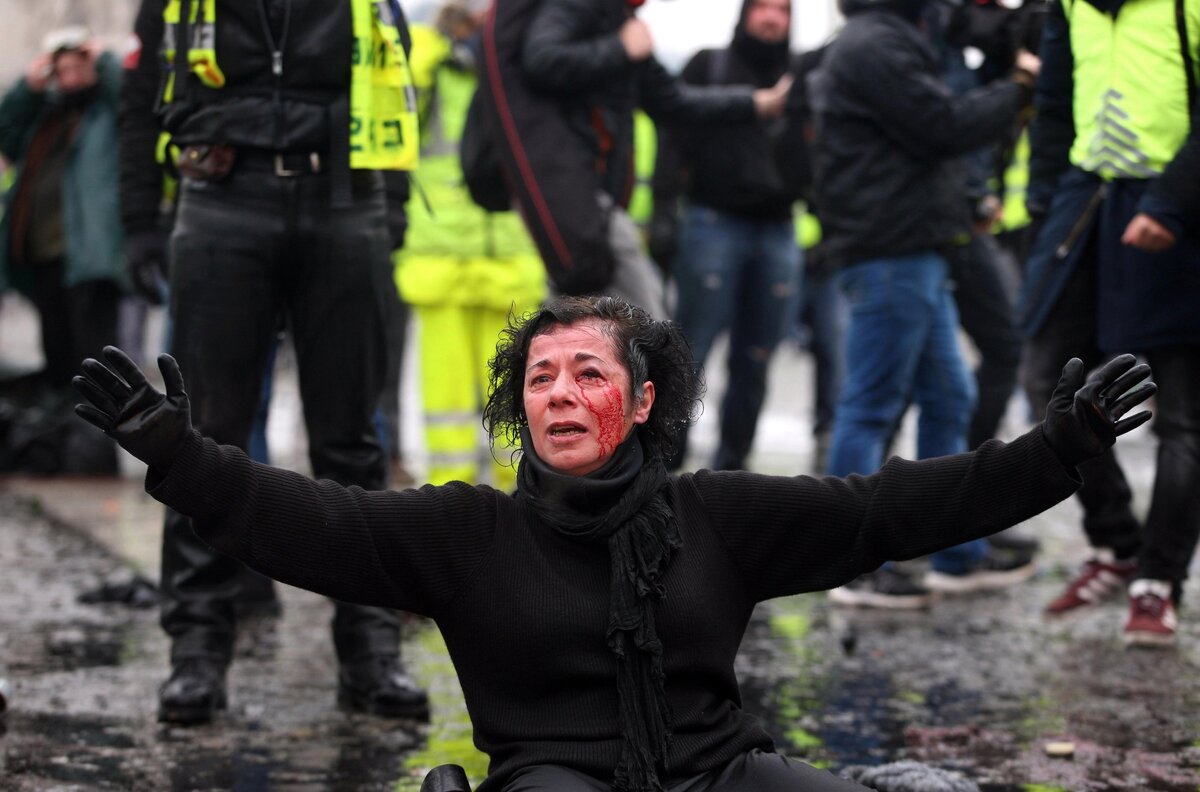 "Yellow Vest" The Irish Sun