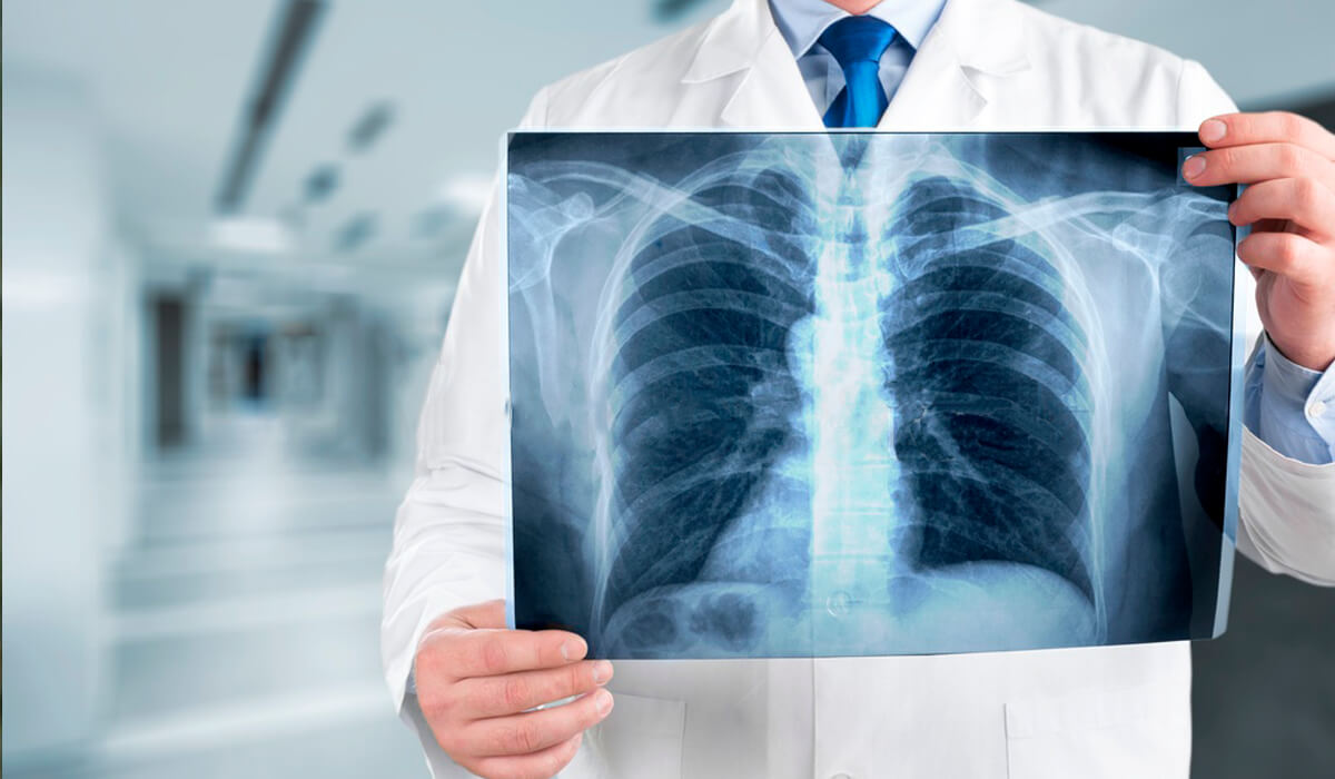 Как отличить пневмонию от бронхита? | Evolutis Clinic | Дзен