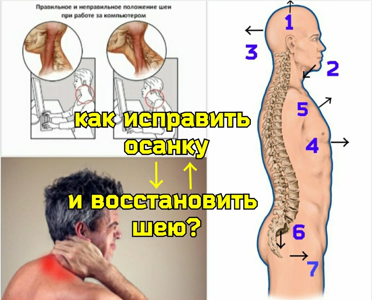 Остеохондроз позвоночника: Шейный, грудной, поясничный — Сеть МЦ «Доктор Боголюбов»