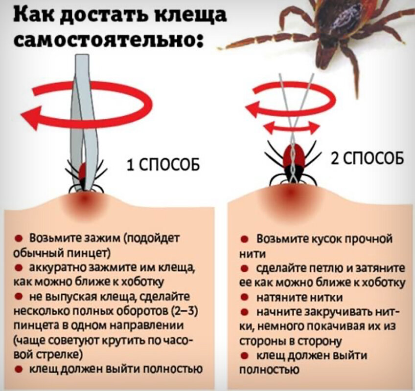 «Клещ, на меня не лезь!». Екатеринбургские медики нашли заговор от клещей