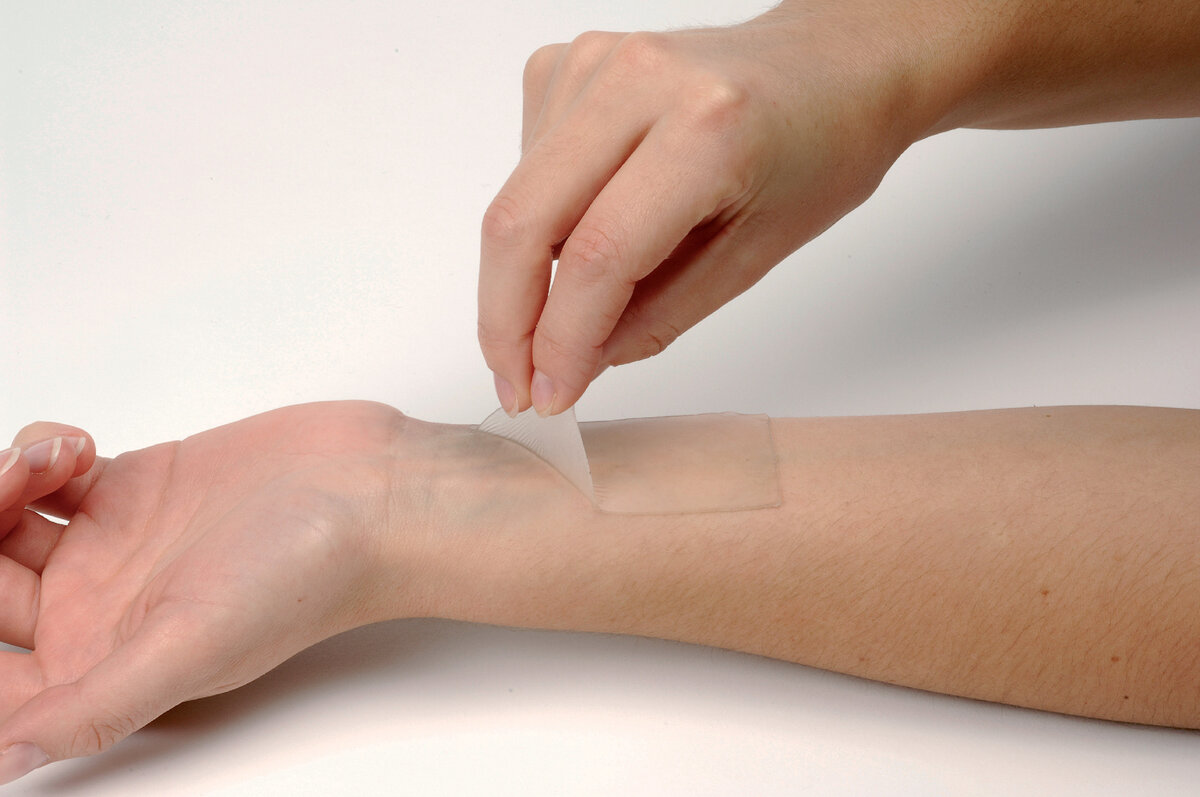 Как убрать шрамы от порезов — особенности лечения молодых и застарелых рубцов