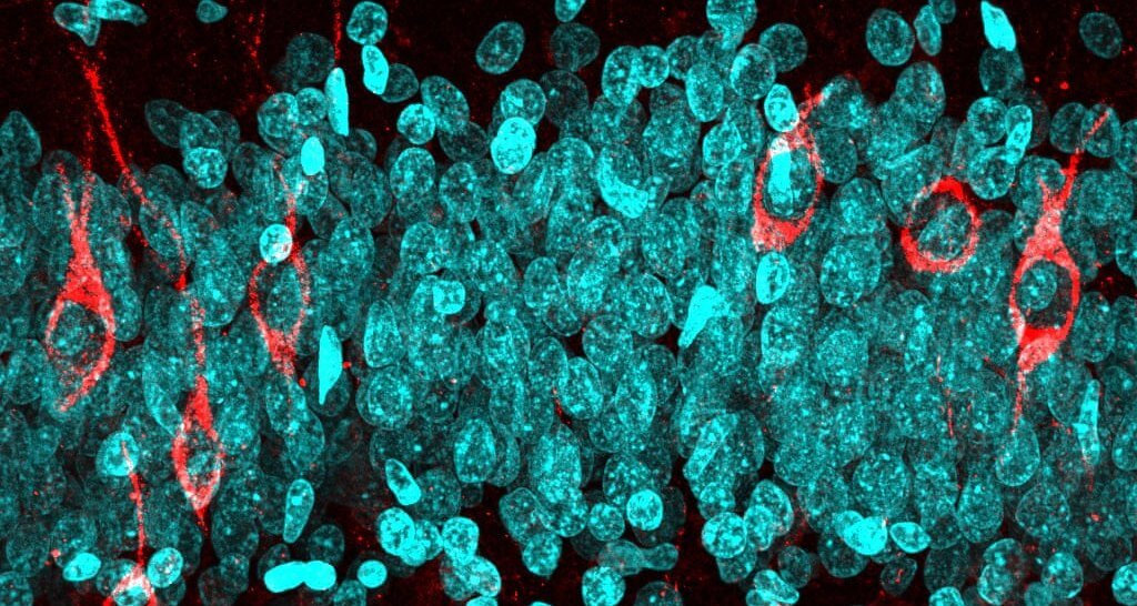     В мозге пожилых людей находят тысячи новых нейронов: нервные клетки все-таки восстанавливаются