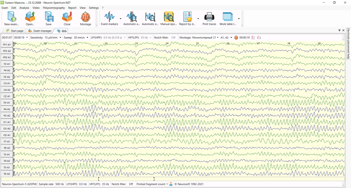 Пример нативных ЭЭГ-кривых