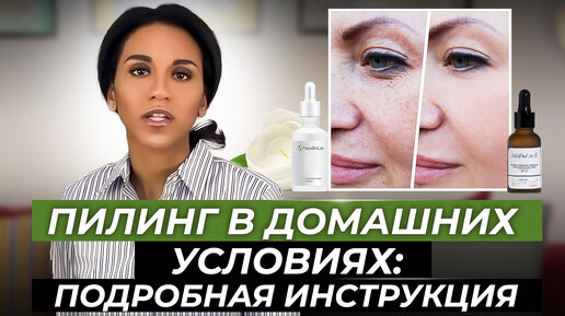 Кислотные пилинги - kosmetik