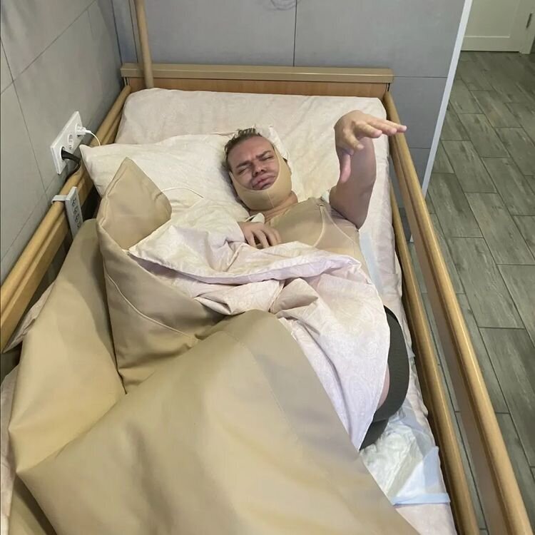    Гоген Солнцев после липосакцииСоцсети