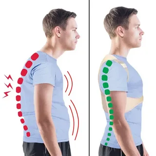 Увеличенный кифоз грудного отдела позвоночника. Фото взято из открытых источников. 