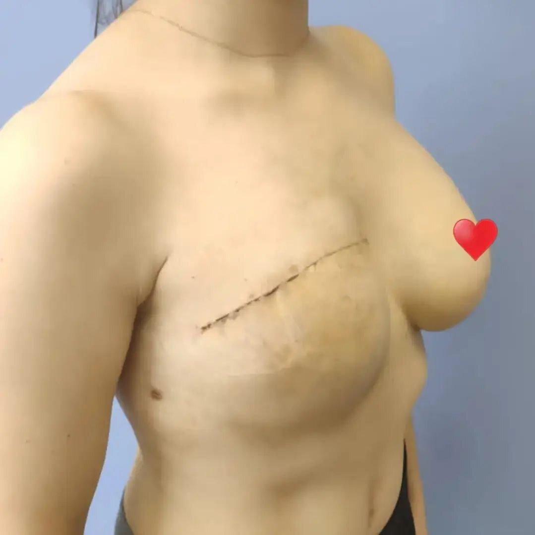 лучшие хирурги по реконструкции груди фото 10