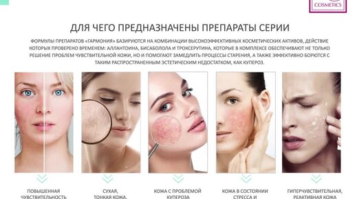 Косметика для ухода за чувствительной кожей