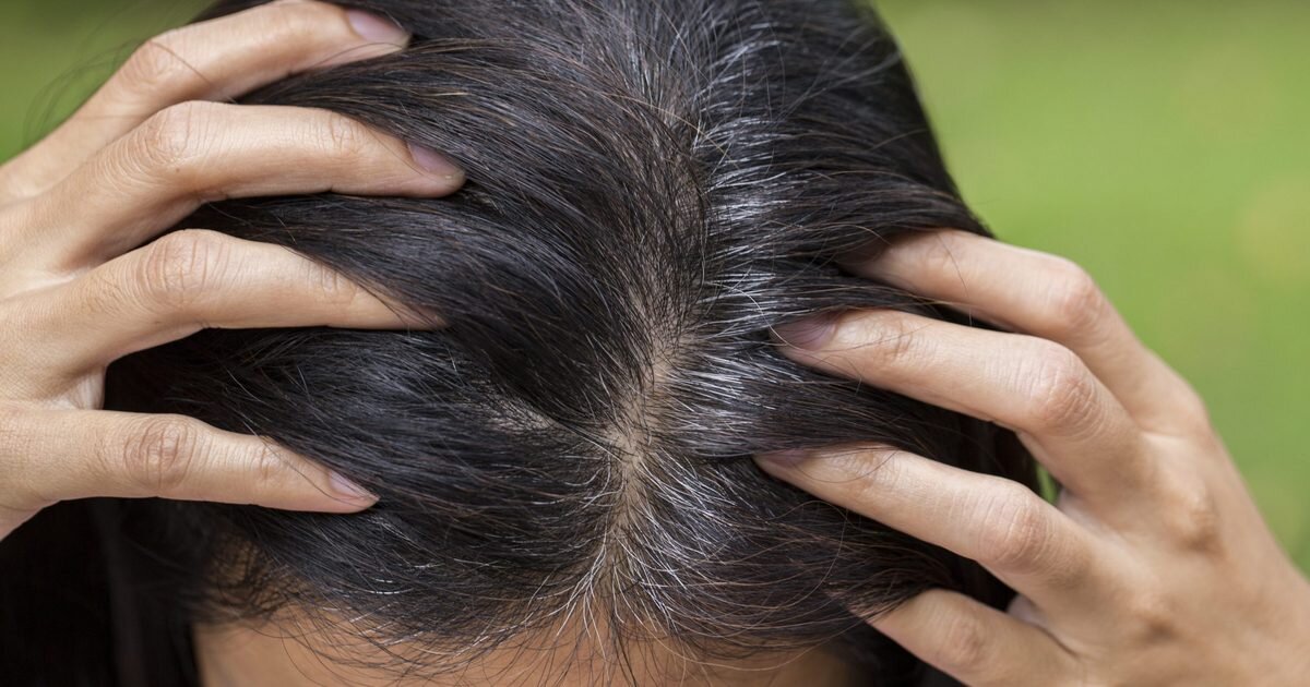 Появление седины, общедоступные источники