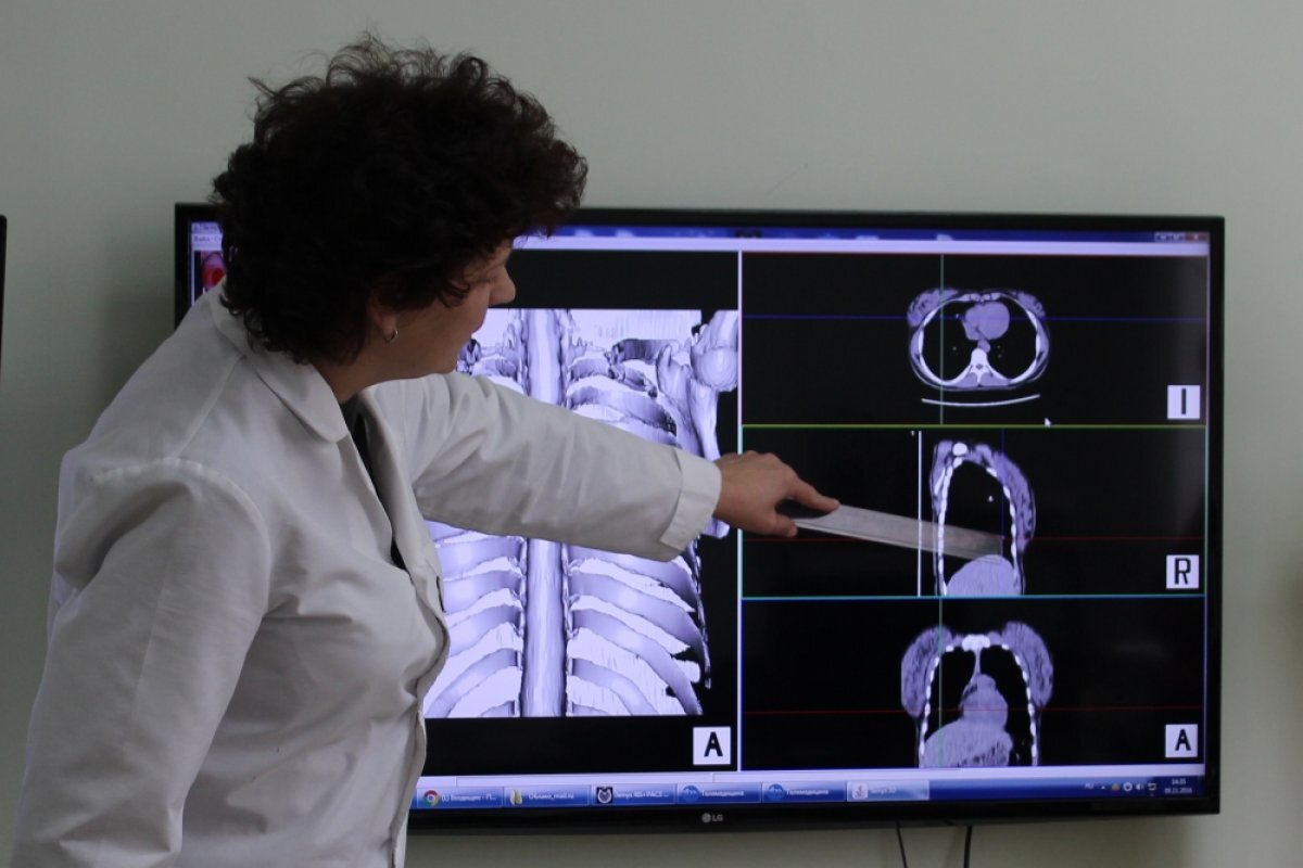    Врач рассказал, сколько сигарет в день повышают риск развития туберкулеза