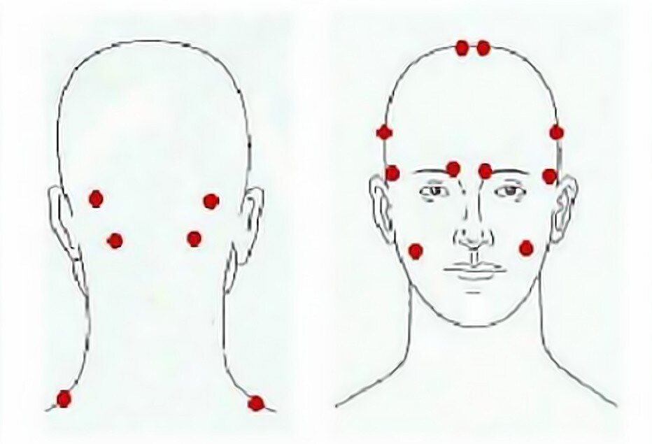 Массаж точек при головной боли схема