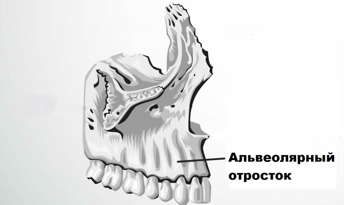 А теперь представьте, что там нет фрагмента кости.