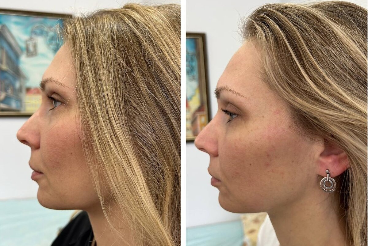 Безопасность и отсутствие побочных эффектов