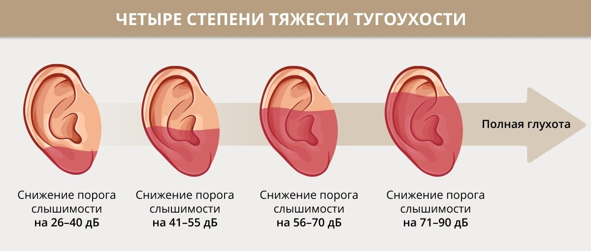 Легкая степень тугоухости. Тугоухость 3-4 степени. Тугоухость 3 степени. 4 Степень глухоты.
