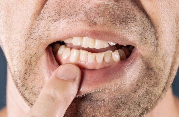 Лечитесь с улыбкой: почему стресс бьёт по зубам