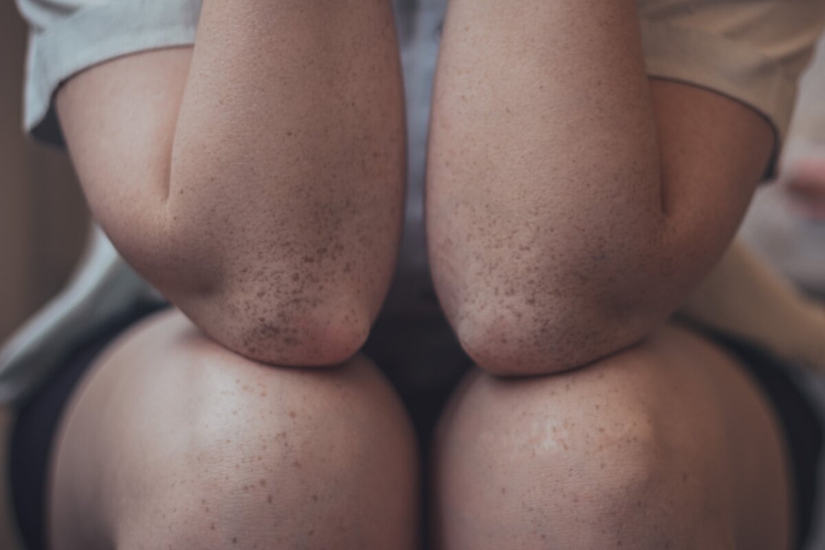    По тому же принципу работают большинство суставов.Photo by Lucaxx Freire on Unsplash