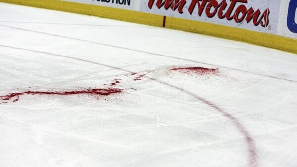   © AP / Brian Slichta