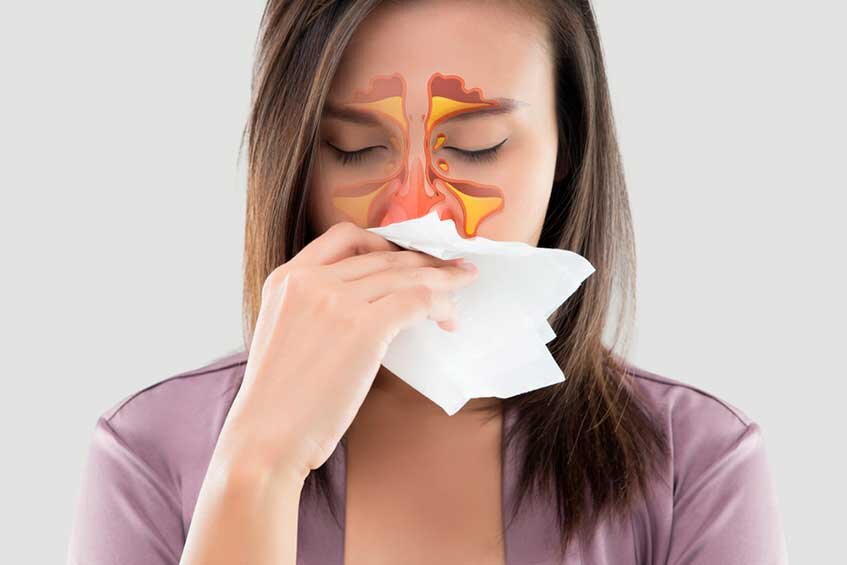 Как лечить синусит у взрослых?