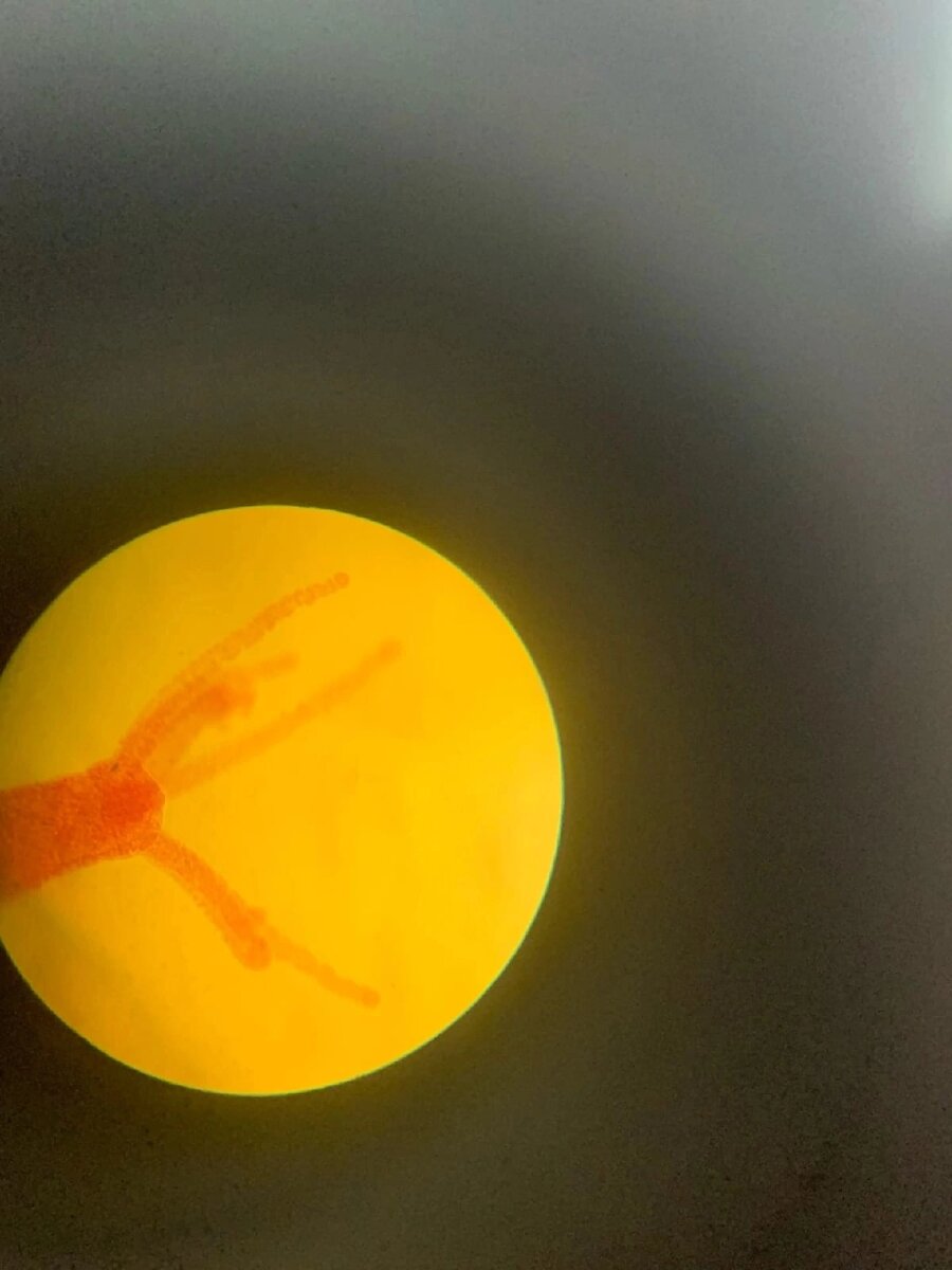 Гидра под микроскопом