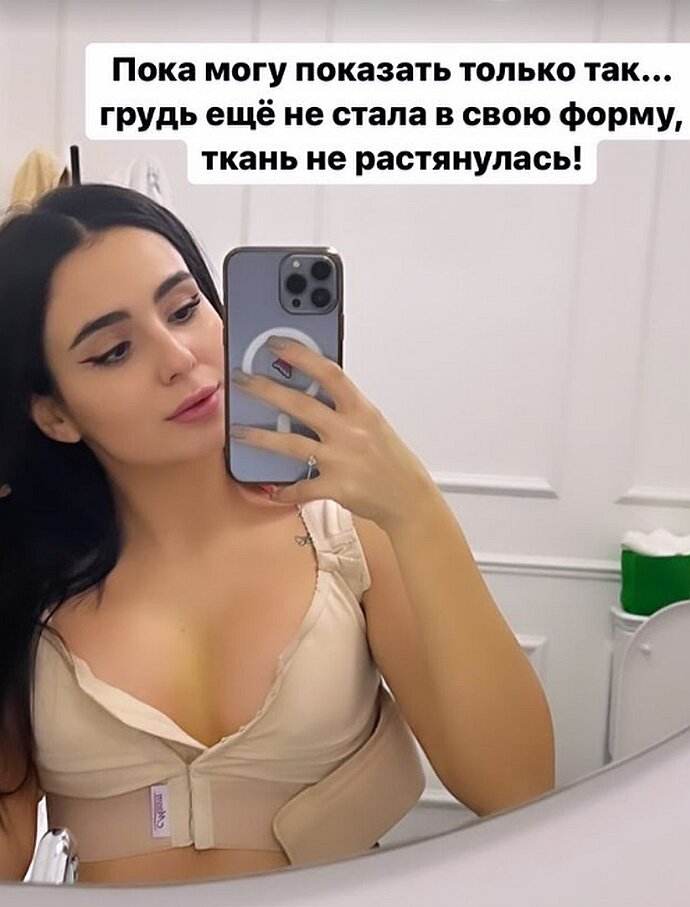 Актриса и певица Анна Тринчер с новым бюстом