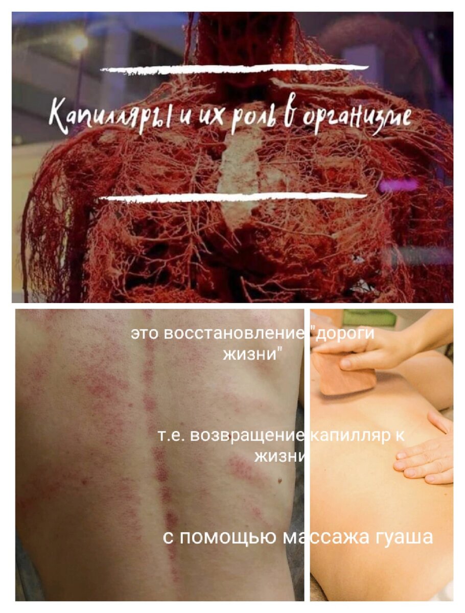 Роль капилляров
Капилляры – мельчайшие кровеносные сосуды, пронизывающие все наши ткани и органы. Свое название получили от латинского слова «capillaris», что означает «волосяной». 
Капилляры – самые тонкие сосуды в организме человека. Они являются частью системы кровообращения наряду с сердцем, артериями, артериолами, венами и венулами. 
Почти во всех органах и тканях нашего тела капилляры образуют кровеносные сеточки подобно паутине.
❗Европейский исследователь Хюшар еще в 
1908 г. назвал капилляры бесчисленными периферическими сердцами. Он обнаружил, что капилляры способны ритмично сокращаться. 
❗А русский врач А.С. Залманов призывал рассматривать каждый капилляр как микросердце с двумя половинами – артериальной и венозной, каждая из которых имеет свой клапан (так он называл сужения на обоих концах капиллярного сосуда). 
❗Капилляры регулируют давление. 
При их расширении происходит снижение артериального давления, а при сужении, 
наоборот – повышение. 
❗Все физиологические процессы, протекающие в организме, связаны именно с изменением просвета капиллярных сосудов. Сужение и расширение капилляров играет роль во всех патологиях: травмы, воспаления, аллергии, инфекции, токсические процессы, а также трофических нарушения.
❗Современная физиология уделяет капиллярам очень мало внимания, хотя именно в этой части сердечно-сосудистой системы идут важнейшие процессы циркуляции крови и обмена веществ. 
По капиллярной сети к каждой клетке организма вместе с кровью поступают кислород и все необходимые питательные вещества, и удаляются углекислый газ с продуктами распада. Этот обмен происходит на границе клетки и капилляра, и пока он в норме, организм сохраняет здоровье и молодость. 
Поэтому путь, по которому кровь проходит по этим мельчайшим окончаниям кровеносного русла, по праву называют «дорогой жизни».
❗Многочисленные исследования доказали, что нарушения связанные с капиллярами являются основной причиной патологических и физиологических изменений ведущих к развитию многих заболеваний. Практически любой недуг связан с замедлением или остановкой кровообращения в капиллярных сосудах в каком-либо месте организма.
Восстановить капилляры Вам поможет специальный массаж гуаша.
💕 Любви Вам, здоровья и понимания жизни 💕
#гуаша #массаж #капилляры #восстановление #кровообращение #недуг #здоровье #капиллярнаясеть
#специальныймассаж
#сосуды #оздоровление #исцеление #возвращениежизни