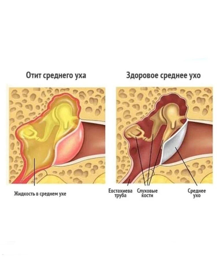 У ребёнка болит ухо: что делать