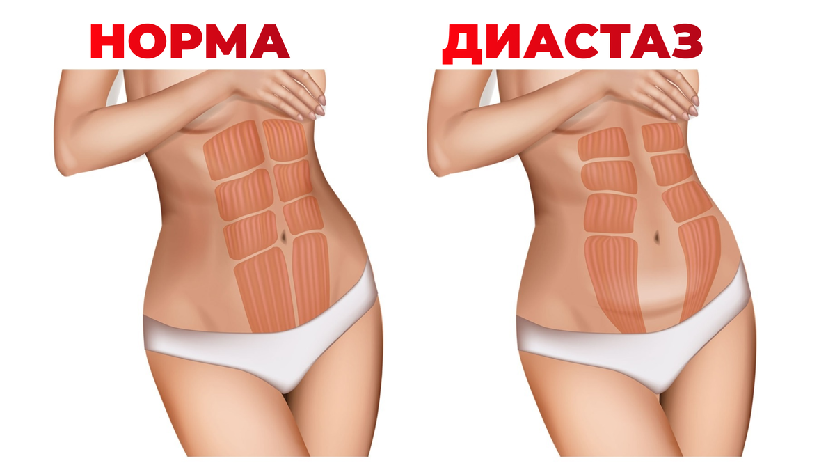 ДИАСТАЗ и ТАНЕЦ ЖИВОТА Танец Позвоночника Дзен