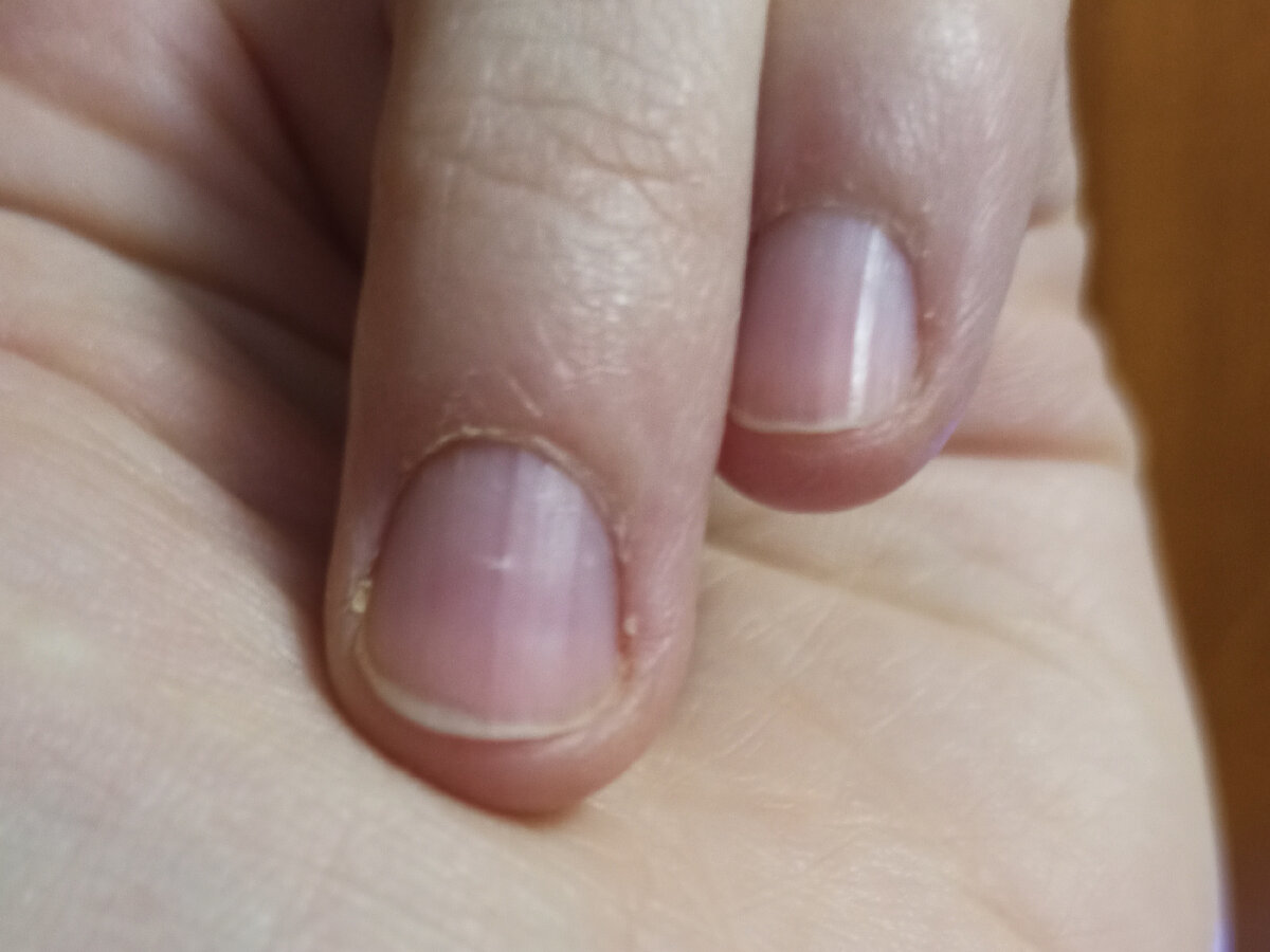 6 способов избавиться от ребристых ногтей: различаем горизонталь и вертикаль