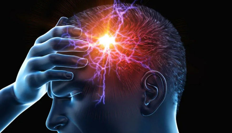 Как лечить мигрень: что можно предпринять самостоятельно. Источник фото — сайт https://www.pinterest.ru