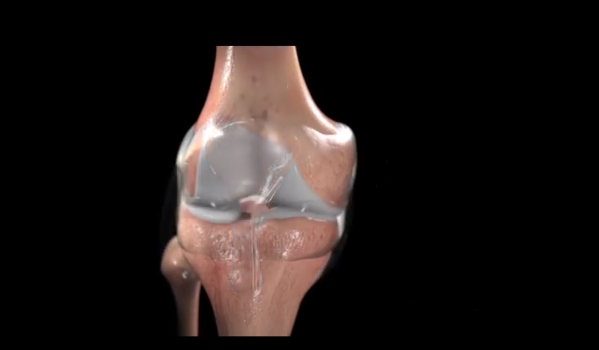 Почему женщины более склонны к остеоартрозу?