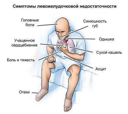 Почему одышка сердце
