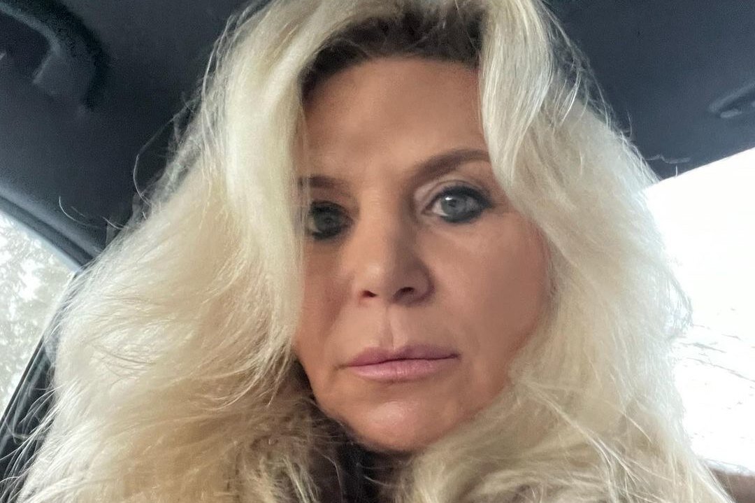     «Я убрала морщинки»: Марина Юдашкина показала лицо после уколов красоты