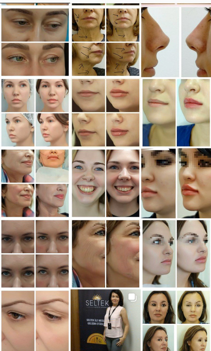 Продвижение врача-косметолога в Санкт-Петербурге